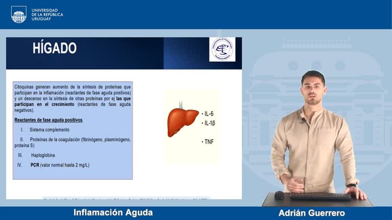 Rol de la Inflamación en la Patología: Inflamación Aguda