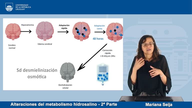 Alteraciones del metabolismo hidrosalino. 2ª Parte: Natremia y Osmolaridad